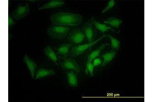 Image no. 4 for anti-PDZ Binding Kinase (PBK) (AA 1-110) antibody (ABIN599274) (PBK 抗体  (AA 1-110))