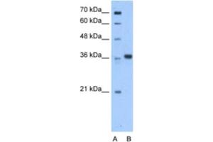Western Blotting (WB) image for anti-Aminoadipate-Semialdehyde Dehydrogenase-phosphopantetheinyl Transferase (AASDHPPT) antibody (ABIN2463215) (AASDHPPT 抗体)