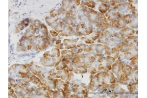 Immunostaining (ISt) image for anti-Mitogen-Activated Protein Kinase 14 (MAPK14) (AA 260-360) antibody (ABIN514653)