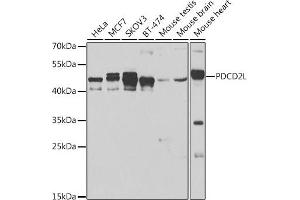 Western blot analysis of extracts of various cell lines, using PDCD2L antibody (ABIN6130653, ABIN6145336, ABIN6145337 and ABIN6223261) at 1:500 dilution. (PDCD2L 抗体  (AA 1-358))