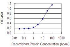 Detection limit for recombinant GST tagged DLST is 0. (DLST 抗体  (AA 1-99))