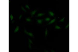 Immunofluorescence staining of Hela Cells with ABIN7127424 at 1:50, counter-stained with DAPI. (Recombinant CHEK1 抗体)