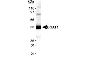 Western blot analysis of DGAT1 in HepG2 lysate using DGAT1 polyclonal antibody . (DGAT1 抗体  (AA 200-300))