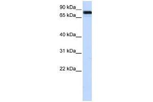EWSR1 antibody used at 1 ug/ml to detect target protein.