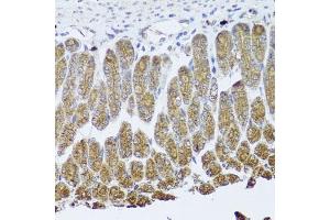 Immunohistochemistry (IHC) image for anti-Neurotrophic Tyrosine Kinase, Receptor, Type 1 (NTRK1) (AA 1-280) antibody (ABIN3022909)