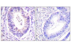 Immunohistochemistry (IHC) image for anti-Ribosomal Protein S6 Kinase, 90kDa, Polypeptide 3 (RPS6KA3) (Thr573) antibody (ABIN1847962) (RPS6KA3 抗体  (Thr573))