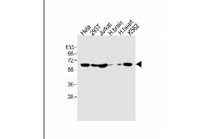 All lanes : Anti-IFNAR1 Antibody (Center) at 1:1000 dilution Lane 1: Hela whole cell lysate Lane 2: 293T whole cell lysate Lane 3: Jurkat whole cell lysate Lane 4: human brain lysate Lane 5: human heart lysate Lane 6: K562 whole cell lysate Lysates/proteins at 20 μg per lane. (IFNAR1 抗体  (AA 162-188))