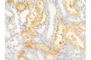 anti-Osteoclast Associated Receptor (OSCAR) antibody