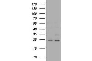 Image no. 2 for anti-RAB21, Member RAS Oncogene Family (RAB21) antibody (ABIN1500546) (RAB21 抗体)