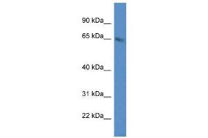 WB Suggested Anti-METTL3 AntibodyTitration: 1. (METTL3 抗体  (C-Term))