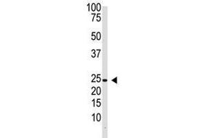 Image no. 1 for anti-Interleukin 29 (IL29) (Center) antibody (ABIN357175) (IL29 抗体  (Center))