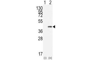 Western blot analysis of CDX2 antibody and 293 cell lysate (2 ug/lane) either nontransfected (Lane 1) or transiently transfected with the human gene (2).