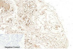 Immunohistochemical analysis of paraffin-embedded human breast tissue. (Caspase 1 抗体  (Cleaved-Asp210))