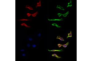 ABIN6262736 and ABIN6277134 staining Hela cells by IF/ICC. (KBTBD3 抗体  (C-Term))