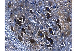 ABIN6259940 and ABIN6268705 at 1/100 staining Rat brain tissue by IHC-P.