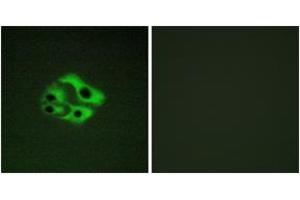 Immunofluorescence analysis of HeLa cells, using BAD (Phospho-Ser134) Antibody. (BAD 抗体  (pSer134))