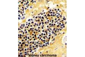 Immunohistochemistry (IHC) image for anti-Killer Cell Lectin-Like Receptor Subfamily C, Member 1 (KLRC1) antibody (ABIN2936813) (KLRC1 抗体)