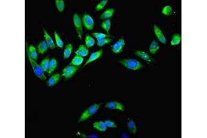 Immunofluorescent analysis of Hela cells using ABIN7160596 at dilution of 1:100 and Alexa Fluor 488-congugated AffiniPure Goat Anti-Rabbit IgG(H+L) (Myosin 9 抗体  (AA 2-241))