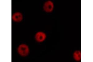 ABIN6266456 staining HuvEc by IF/ICC. (HNRNPD/AUF1 抗体  (pSer83))