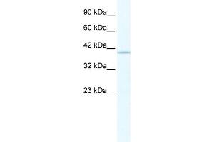 WB Suggested Anti-TRIM68 Antibody Titration:  2. (TRIM68 抗体  (C-Term))
