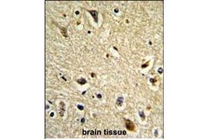 Immunohistochemistry (Paraffin-embedded Sections) (IHC (p)) image for anti-Cytochrome P450, Family 2, Subfamily E, Polypeptide 1 (CYP2E1) (AA 402-429), (C-Term) antibody (ABIN652585)