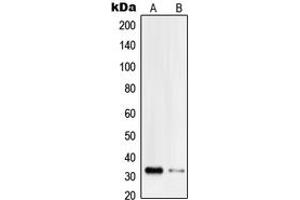 Western blot analysis of PI-TP beta expression in Jurkat (A), HeLa (B) whole cell lysates. (PITPNB 抗体  (Center))