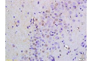 Formalin-fixed and paraffin embedded rat brain tissue labeled with Anti OCT4B-190 Polyclonal Antibody, Unconjugated  at 1:200 followed by conjugation to the secondary antibody and DAB staining (Oct-4BOCT4B-190NT (AA 201-300) 抗体)