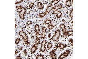 Immunohistochemical staining of human breast with ZNF146 polyclonal antibody  shows strong nuclear positivity in glandular cells at 1:50-1:200 dilution.