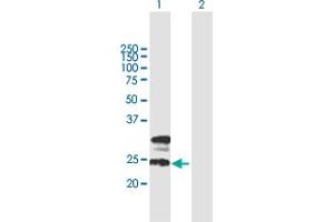 Western Blot analysis of TMEM27 expression in transfected 293T cell line by TMEM27 MaxPab polyclonal antibody. (TMEM27 抗体  (AA 1-222))