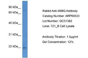 WB Suggested Anti-WIBG  Antibody Titration: 0. (PYM 抗体  (C-Term))