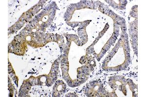 IHC analysis of TIMP4 using anti- TIMP4 antibody . (TIMP4 抗体  (AA 174-224))