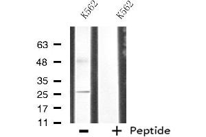 Western blot analysis of extracts from K562 cells, using CDC42EP3 antibody. (CDC42EP3 抗体  (Internal Region))