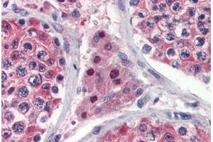 Immunohistochemistry (Paraffin-embedded Sections) (IHC (p)) image for anti-Isocitrate Dehydrogenase 1 (NADP+), Soluble (IDH1) (AA 290-339) antibody (ABIN6741619)