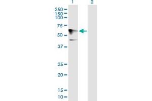 Western Blot analysis of HOMEZ expression in transfected 293T cell line by HOMEZ MaxPab polyclonal antibody. (HOMEZ 抗体  (AA 1-526))