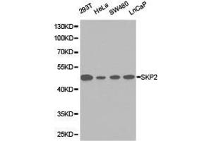 Western Blotting (WB) image for anti-S-Phase Kinase-Associated Protein 2 (SKP2) antibody (ABIN1874793) (SKP2 抗体)