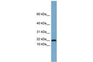 Image no. 1 for anti-Proline Rich 13 (PRR13) (AA 35-84) antibody (ABIN6744150) (Proline Rich 13 抗体  (AA 35-84))