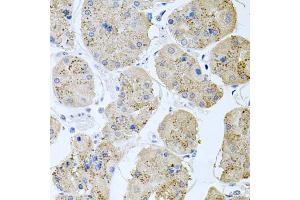 Immunohistochemistry of paraffin-embedded human stomach using RAPSN antibody (ABIN6132583, ABIN6146690, ABIN6146691 and ABIN6222434) at dilution of 1:100 (40x lens). (RAPSN 抗体  (AA 1-353))