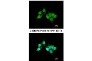 ICC/IF Image Immunofluorescence analysis of paraformaldehyde-fixed A431, using RCC1, antibody at 1:200 dilution. (RCC1 抗体)