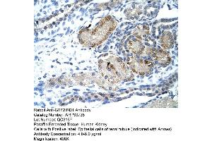 Immunohistochemistry (IHC) image for anti-General Transcription Factor II I Repeat Domain-Containing 1 (GTF2IRD1) (C-Term) antibody (ABIN2778093)