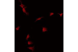 ABIN6275059 staining Hela by IF/ICC. (DKK3 抗体  (C-Term))