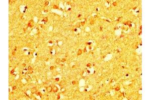 IHC image of ABIN7167266 diluted at 1:200 and staining in paraffin-embedded human brain tissue performed on a Leica BondTM system. (RAB26 抗体  (AA 1-58))