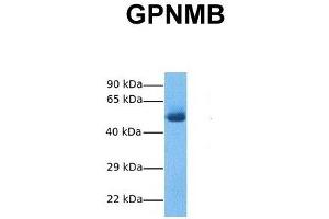 Host:  Rabbit  Target Name:  GPNMB  Sample Tissue:  Human Fetal Lung  Antibody Dilution:  1. (Osteoactivin 抗体  (N-Term))