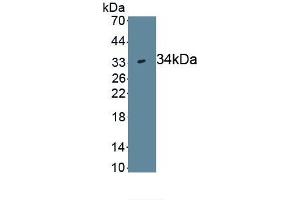 Detection of Recombinant WNT7B, Human using Monoclonal Antibody to Wingless Type MMTV Integration Site Family, Member 7B (WNT7B) (WNT7B 抗体  (AA 216-349))