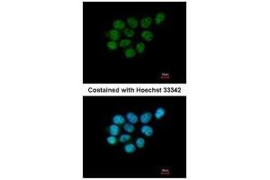 ICC/IF Image Immunofluorescence analysis of paraformaldehyde-fixed A431, using ARIH2, antibody at 1:200 dilution. (ARIH2 抗体  (C-Term))