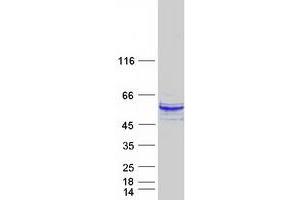 Western Blotting (WB) image for SH2 Domain Protein 2A (SH2D2A) protein (Myc-DYKDDDDK Tag) (ABIN2731961)
