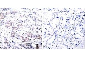Immunohistochemistry (IHC) image for anti-ELK1, Member of ETS Oncogene Family (ELK1) (AA 351-400) antibody (ABIN1532857)