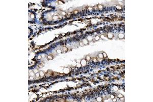IHC analysis of USP16 using anti-USP16 antibody (ABIN7602640). (USP16 抗体  (AA 9-823))