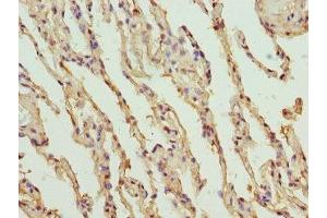Immunohistochemistry of paraffin-embedded human lung tissue using ABIN7151751 at dilution of 1:100 (PROCR 抗体  (AA 18-210))