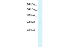 Human HepG2; WB Suggested Anti-PSMD14 Antibody Titration: 0. (PSMD14 抗体  (C-Term))