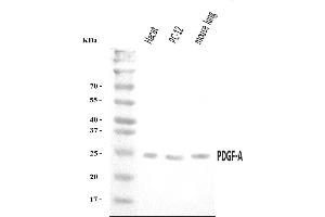 Western blot analysis of PDGF AA/PDGFA using anti-PDGF AA/PDGFA antibody (ABIN7602580). (PDGFA 抗体  (AA 87-211))